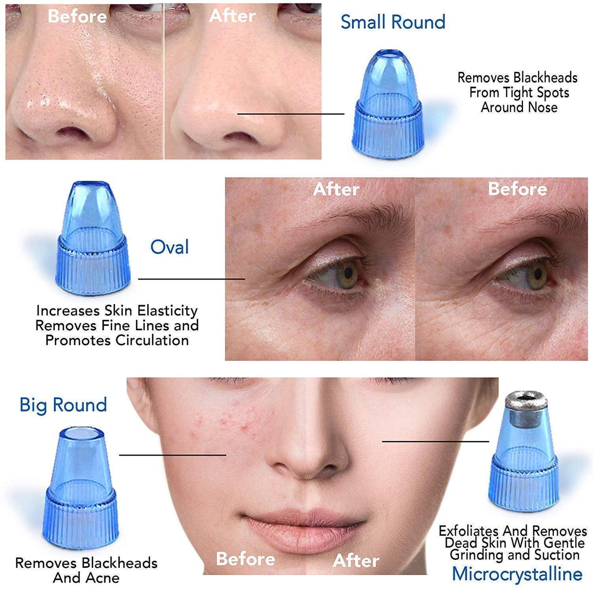 Blackhead Acne Oil Remover